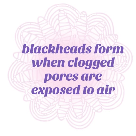 blackheads form when clogged pores are expose to air